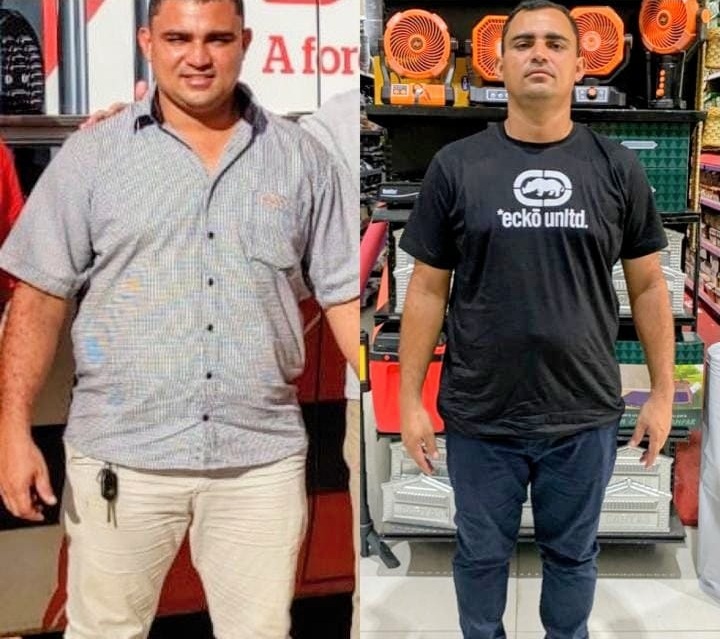 Resultado de emagrecimento -15kg